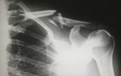 Living with cancer. How did I get here?